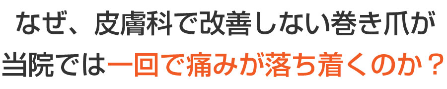 巻き爪,広島,廿日市市