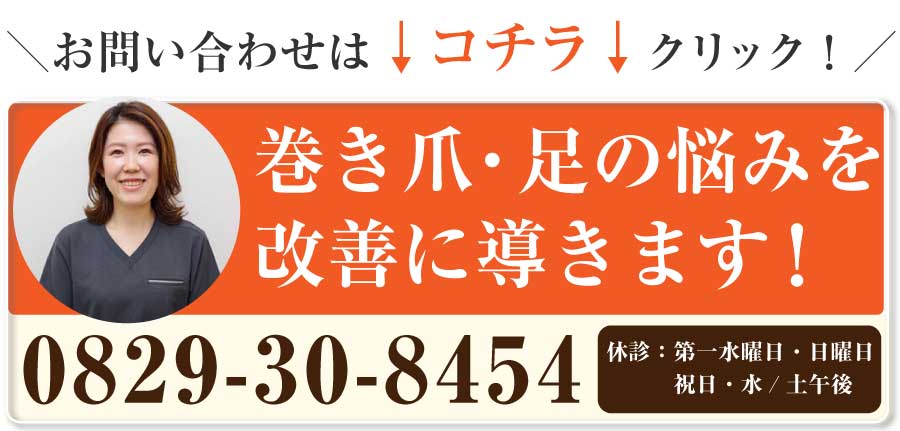 巻き爪,広島,廿日市市